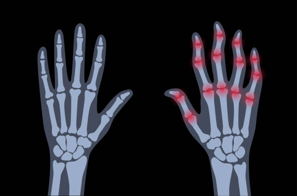 Congenital Hand Deformities