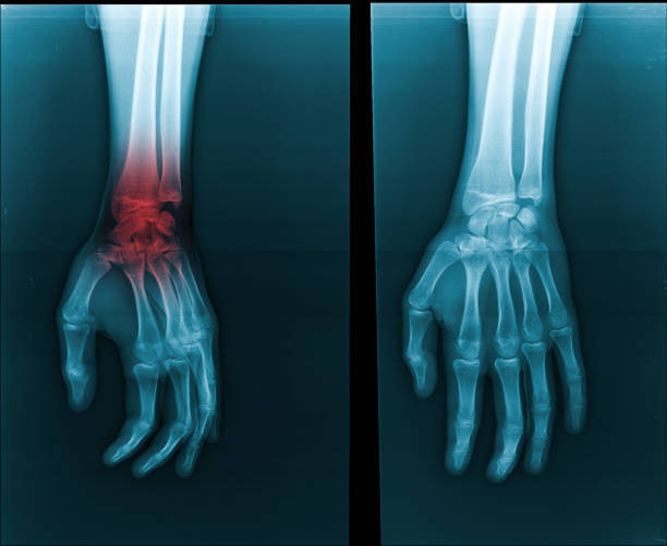 Expert Care for Hand Bone Tumors: Dr. Nishant Soni in South Delhi