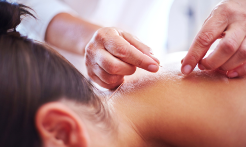 Best Physiotherapy Care in South Delhi